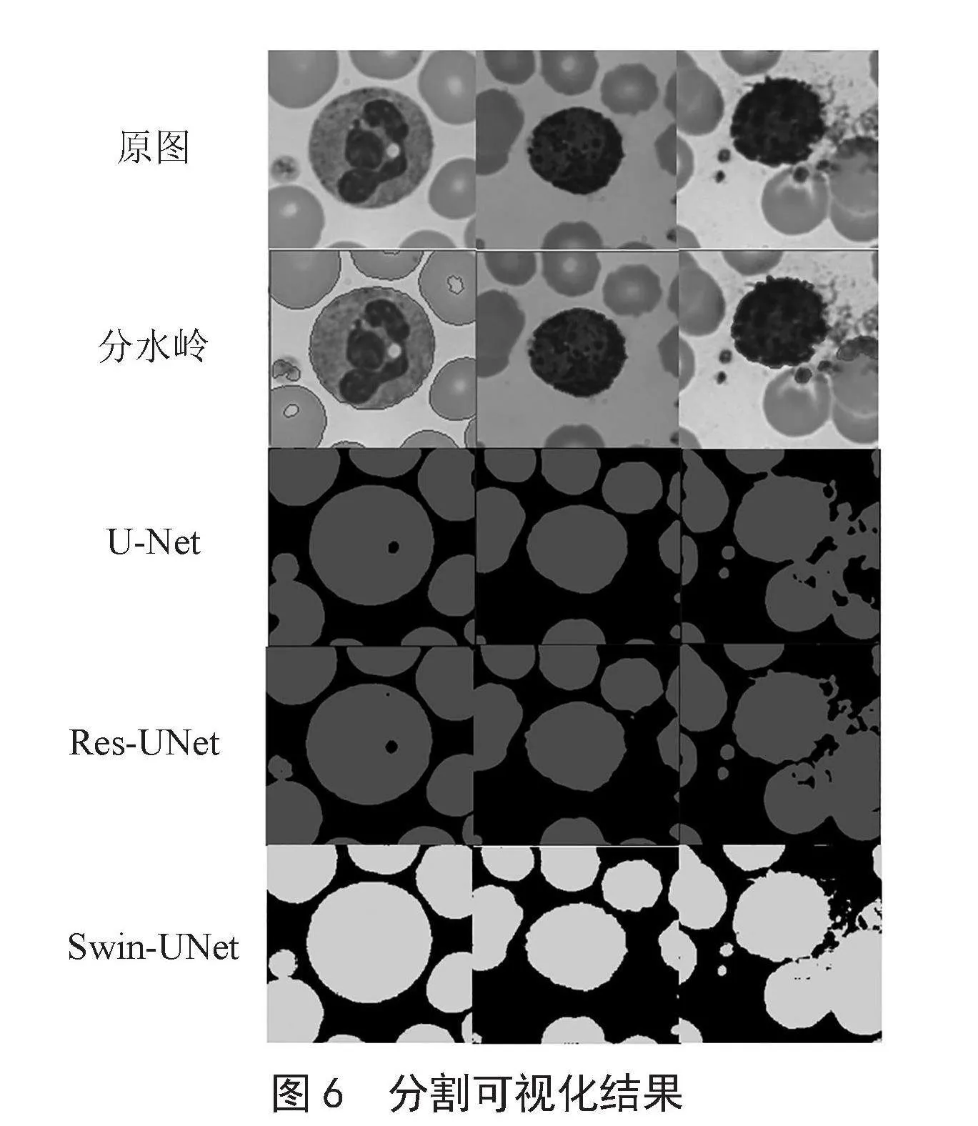 基于Swin-UNet血细胞分割方法研究